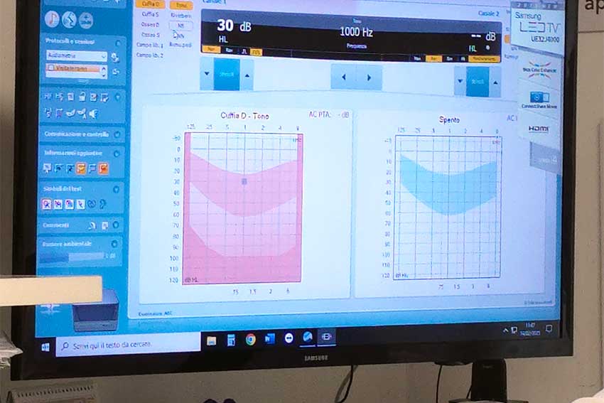 Centro-Audioprotesico Taranto Otosalus percorsi